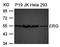 ETS Transcription Factor ERG antibody, orb43430, Biorbyt, Western Blot image 