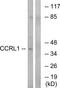 Atypical Chemokine Receptor 4 antibody, TA315482, Origene, Western Blot image 