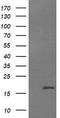 Cancer/Testis Antigen 1B antibody, TA505955S, Origene, Western Blot image 