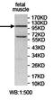 Potassium Channel Tetramerization Domain Containing 19 antibody, orb78157, Biorbyt, Western Blot image 