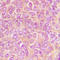 Cytoplasmic Linker Associated Protein 1 antibody, LS-C358454, Lifespan Biosciences, Immunohistochemistry paraffin image 