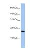 ADP Ribosylation Factor Like GTPase 5A antibody, NBP1-58304, Novus Biologicals, Western Blot image 