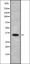 ATP Binding Cassette Subfamily C Member 11 antibody, orb338049, Biorbyt, Western Blot image 