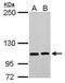 Erythrocyte Membrane Protein Band 4.1 Like 3 antibody, PA5-27528, Invitrogen Antibodies, Western Blot image 