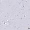 Annexin A2 antibody, HPA061798, Atlas Antibodies, Immunohistochemistry paraffin image 
