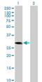Coiled-Coil Domain Containing 88B antibody, H00283234-B01P, Novus Biologicals, Western Blot image 