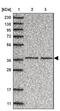 Chromosome 3 Open Reading Frame 38 antibody, NBP1-81147, Novus Biologicals, Western Blot image 