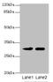 Integral Membrane Protein 2A antibody, A62806-100, Epigentek, Western Blot image 