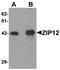 Solute Carrier Family 39 Member 12 antibody, A10066, Boster Biological Technology, Western Blot image 