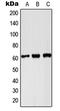 PK1 antibody, LS-C353765, Lifespan Biosciences, Western Blot image 