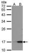 Regenerating Family Member 3 Alpha antibody, PA5-28780, Invitrogen Antibodies, Western Blot image 