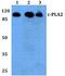 Phospholipase A2 Group IVA antibody, LS-B11332, Lifespan Biosciences, Western Blot image 