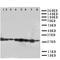Cytokine-inducible SH2-containing protein antibody, orb76299, Biorbyt, Western Blot image 
