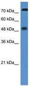 Vitamin D3 receptor antibody, TA329229, Origene, Western Blot image 