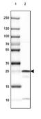 3-Hydroxybutyrate Dehydrogenase 2 antibody, PA5-57501, Invitrogen Antibodies, Western Blot image 