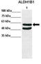 Aldehyde Dehydrogenase 1 Family Member B1 antibody, TA344350, Origene, Western Blot image 