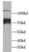 ATP Binding Cassette Subfamily F Member 2 antibody, FNab00041, FineTest, Western Blot image 
