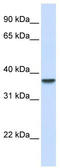 Dimethylarginine Dimethylaminohydrolase 1 antibody, TA334439, Origene, Western Blot image 