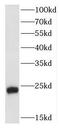 Fibroblast Growth Factor 8 antibody, FNab03095, FineTest, Western Blot image 