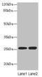 EEF1A Lysine Methyltransferase 1 antibody, LS-C371664, Lifespan Biosciences, Western Blot image 