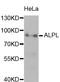 Alkaline Phosphatase, Biomineralization Associated antibody, LS-C331245, Lifespan Biosciences, Western Blot image 