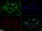 Forkhead Box O1 antibody, NBP2-31376, Novus Biologicals, Immunofluorescence image 
