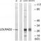 Low Density Lipoprotein Receptor Class A Domain Containing 2 antibody, PA5-50050, Invitrogen Antibodies, Western Blot image 