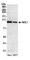 Putative ribosomal RNA methyltransferase NOP2 antibody, A302-018A, Bethyl Labs, Western Blot image 