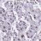 RNA Polymerase I Subunit A antibody, HPA031513, Atlas Antibodies, Immunohistochemistry paraffin image 