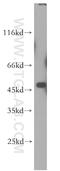 Abhydrolase Domain Containing 2 antibody, 14039-1-AP, Proteintech Group, Western Blot image 