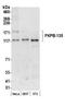 FKBP Prolyl Isomerase 15 antibody, NB100-422, Novus Biologicals, Western Blot image 