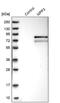 MAGUK p55 subfamily member 3 antibody, PA5-55168, Invitrogen Antibodies, Western Blot image 