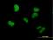 Probable histone-lysine N-methyltransferase NSD2 antibody, H00007468-B01P, Novus Biologicals, Immunocytochemistry image 