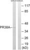 Pre-MRNA Processing Factor 38A antibody, LS-C120245, Lifespan Biosciences, Western Blot image 