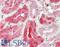STAT3 antibody, LS-B11150, Lifespan Biosciences, Immunohistochemistry paraffin image 