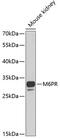 CD-MPR antibody, GTX55693, GeneTex, Western Blot image 