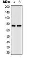Bruton Tyrosine Kinase antibody, LS-C353914, Lifespan Biosciences, Western Blot image 