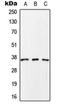 Secretory Carrier Membrane Protein 1 antibody, orb214906, Biorbyt, Western Blot image 