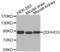 Zinc Finger DHHC-Type Containing 5 antibody, abx002439, Abbexa, Western Blot image 