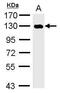 Histone Deacetylase 7 antibody, PA5-28339, Invitrogen Antibodies, Western Blot image 