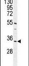 Chromosome 18 Open Reading Frame 25 antibody, PA5-24485, Invitrogen Antibodies, Western Blot image 