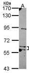 MKS Transition Zone Complex Subunit 1 antibody, NBP2-17303, Novus Biologicals, Western Blot image 
