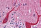 Protein Kinase Domain Containing, Cytoplasmic antibody, MBS247740, MyBioSource, Immunohistochemistry frozen image 