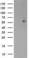 Peroxisome Proliferator Activated Receptor Alpha antibody, TA503540, Origene, Western Blot image 