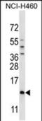 Sperm Mitochondria Associated Cysteine Rich Protein antibody, PA5-48460, Invitrogen Antibodies, Western Blot image 
