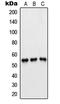 6-phosphofructo-2-kinase/fructose-2,6-biphosphatase 1 antibody, MBS820152, MyBioSource, Western Blot image 
