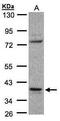 Coiled-Coil Domain Containing 68 antibody, PA5-21801, Invitrogen Antibodies, Western Blot image 