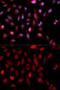 SET1 antibody, GTX30067, GeneTex, Immunofluorescence image 