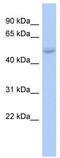 LIM/homeobox protein Lhx5 antibody, TA331774, Origene, Western Blot image 