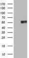 Retinoic Acid Receptor Alpha antibody, TA806243, Origene, Western Blot image 